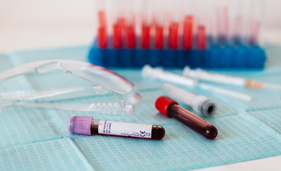 Two samples of blood in tests tubes laid down next to safety goggles in a laboratory with more test tubes in the background.