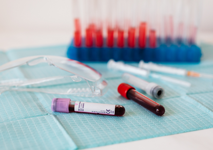 Two samples of blood in tests tubes laid down next to safety goggles in a laboratory with more test tubes in the background.