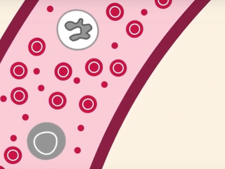 A close up diagram of the inside of a blood cancer cell.