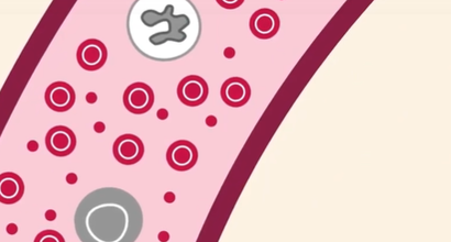 A close up diagram of the inside of a blood cancer cell.