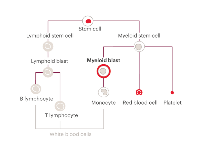 This diagram shows the different stages that cells go through as the grow, and as they become different types of blood cell. The diagram shows that stem cells can grow into lymphoid stem cells or myeloid stem cells. Lymphoid stem cells then grow into lymphoid blast cells and then either B lymphocytes or T lymphocytes, which are both types of white blood cell. Myeloid stem cells can grow into platelets (which help the blood to clot and prevent bleeding), red blood cells (which carry oxygen around the body), or myeloid blast cells. Myeloid blast cells then grow into monocytes or neutrophils and other granulocytes, which are all types of white blood cell. The myeloid blast cell in this diagram is highlighted, because it's the type of cell that AML affects.