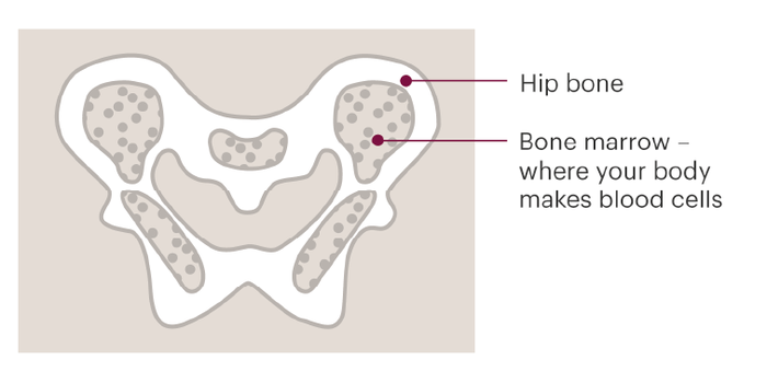 A diagram of a person's hip bones, labelled as 'Hip bone'. In the middle of the larger areas of bone, there is a spongy area labelled as 'Bone marrow, where your body makes blood cells'.