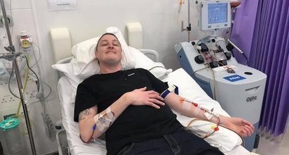 Grant having his T-cells collected. He's smiling while lying on a hospital bed. He's connected by thin tubes in each arm to an apheresis machine (a machine that separates blood) that's next to the bed.