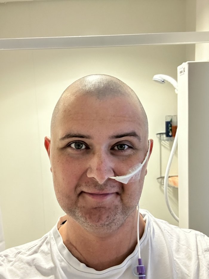 Matt during his treatment in hospital. He has a tube coming out of his nose, looped over his ear and running down beside his neck. He is bald due to treatment side effects.