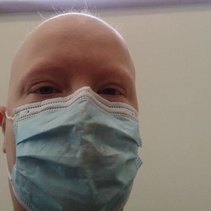 Katherine in the middle of treatment for NHL, wearing a surgical mask and showing the extent of her hair loss
