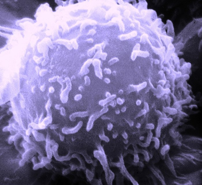 A microscope image of a single human lymphocyte