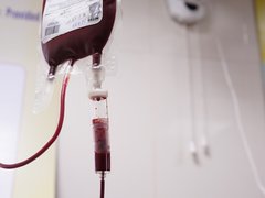 A bag of blood on a drip, ready to transfuse to someone with blood cancer.