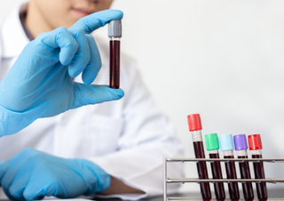 Can a Blood Test Detect Cancer in the Body?