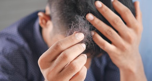 Hair loss