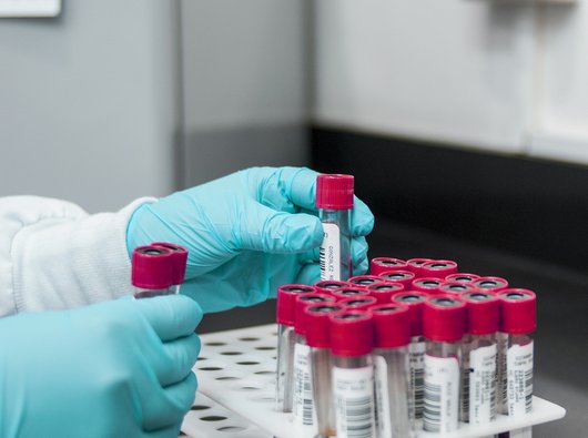 A researcher puts test tubes containing blood into a rack