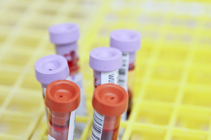 Test tubes stored in a rack